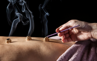 Moxibustion… Let Me Count the Ways