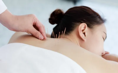 It’s your first acupuncture appointment. What can you expect?